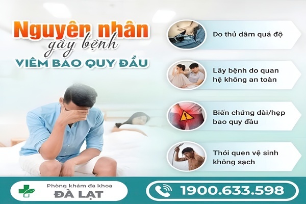 Hình ảnh minh họa